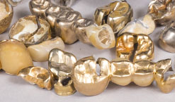 Zahngold